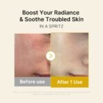Kojic Acid Turmeric Vitamin Gold Jelly Mist Serum - Image 4