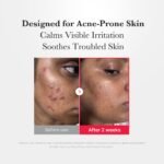 [Subscr.] Hypochlorous Acid Power Soothing Spray - Image 5