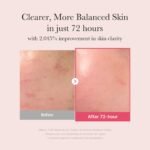 [GIFT] TXA Niacinamide Serum - Image 3
