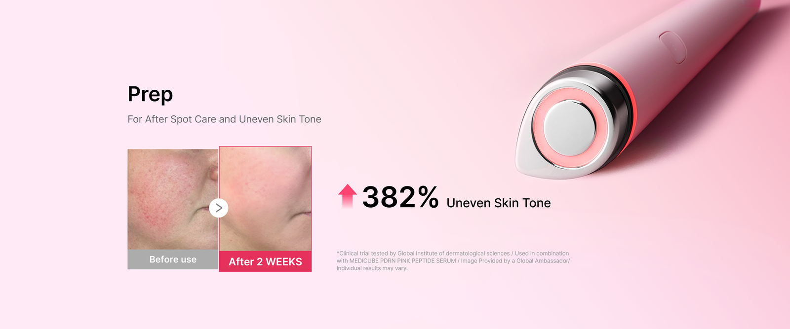For After Spot Care and Uneven Skin Tone
